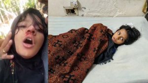 কাঠালিয়ায় পড়া না পারায় শিশু শিক্ষার্থী রক্তাক্ত জখম অভিযোগ শিক্ষকের বিরুদ্ধে