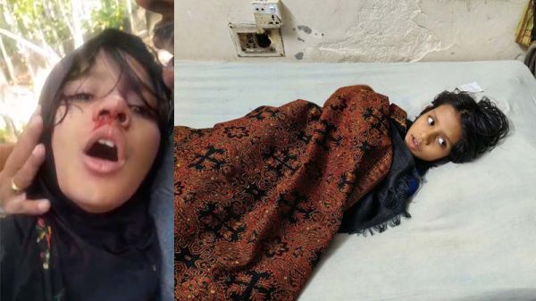 কাঠালিয়ায় পড়া না পারায় শিশু শিক্ষার্থী রক্তাক্ত জখম অভিযোগ শিক্ষকের বিরুদ্ধে